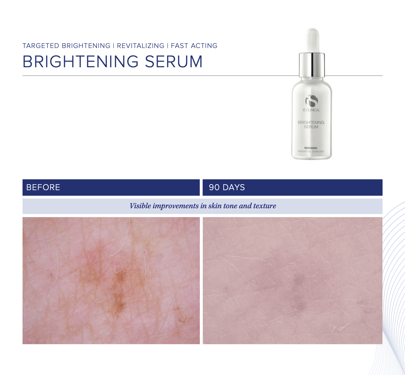 BRIGHTENING SERUM