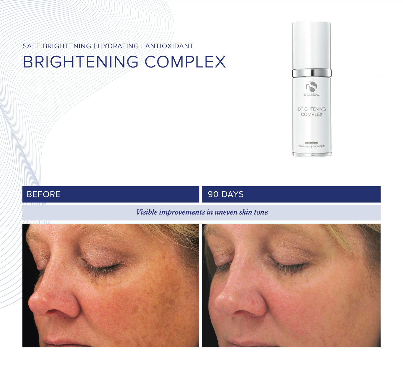 BRIGHTENING COMPLEX
